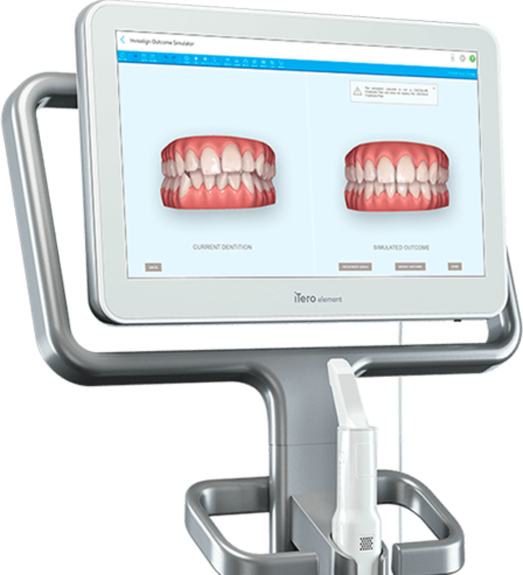 iTero 3D Scanner